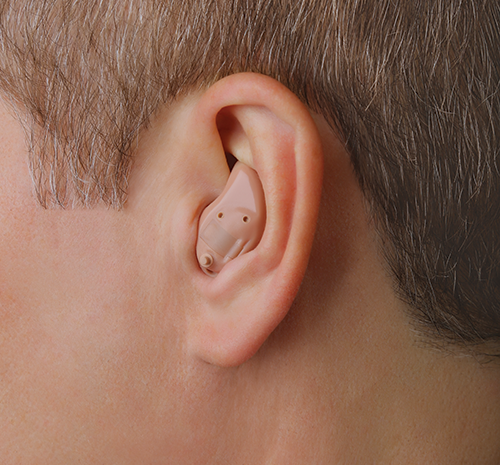  Intra-Auricular (ITE)